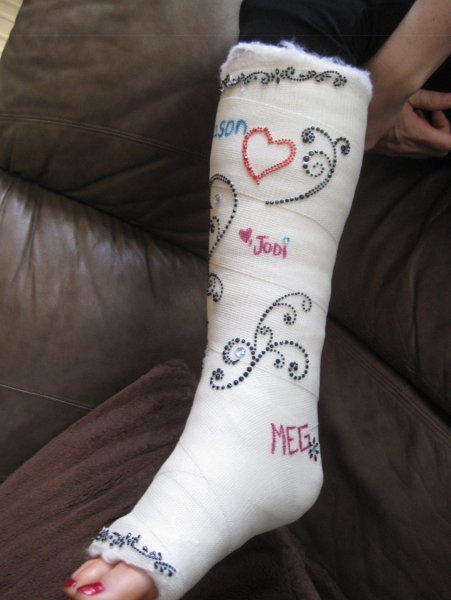 Рисунки на гипсе на ноге