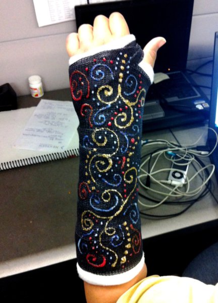 Роспись гипса на руке