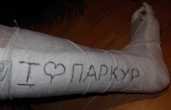 Разрисованный гипс на ноге