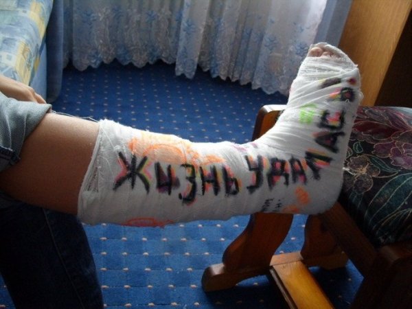 Разрисованный гипс на ноге