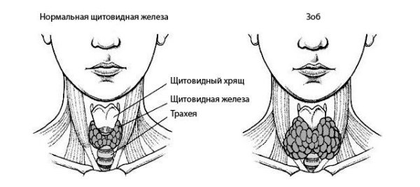 Щитовидная железа расположение схема рисунок