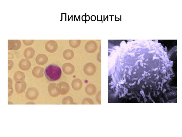 Лимфоциты электронный микроскоп