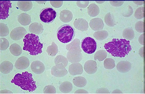 Разновидности лейкоцитов крови