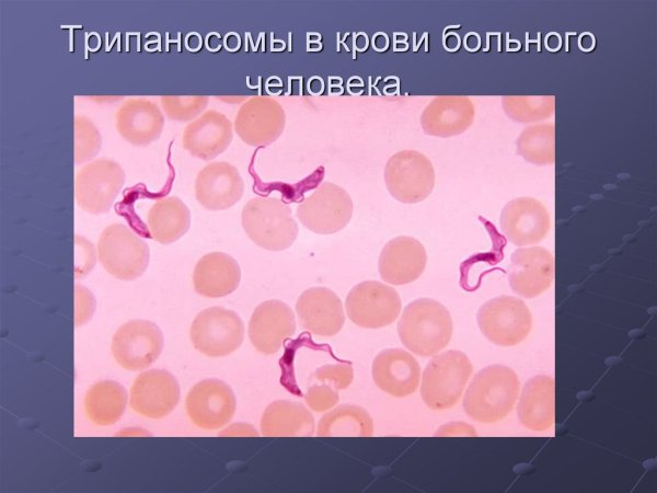 Трипаносома cruzi