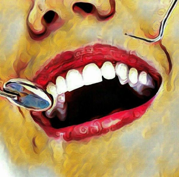 Зуб картина