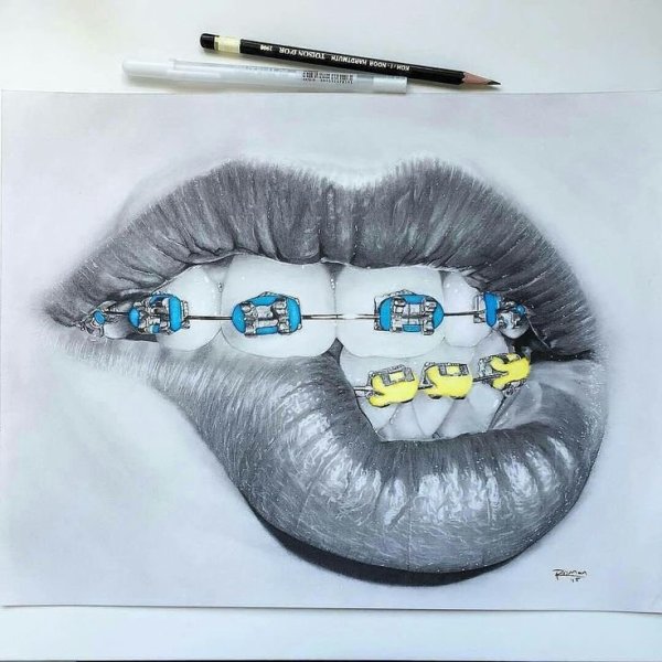 Брекеты нарисованные