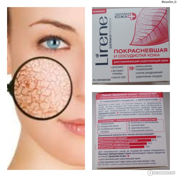 Крем для укрепления сосудов лица