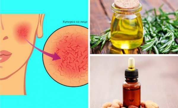 Миндальное масло от прыщей