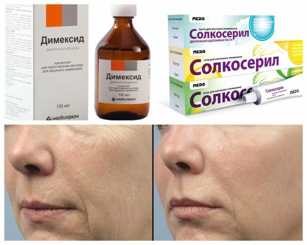 Растворы для обработки глаз