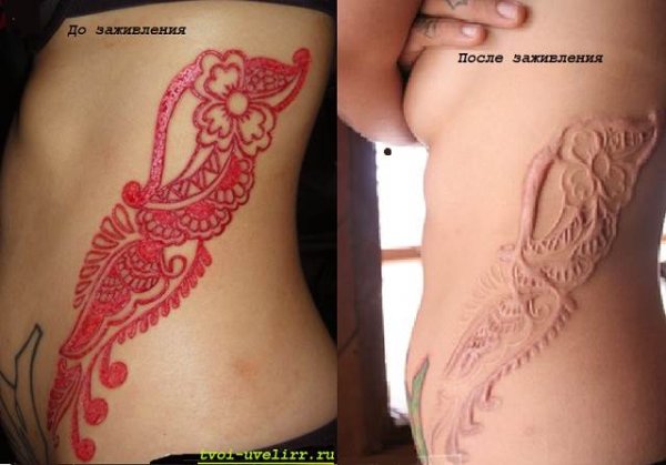 Неправильное заживление Татуировки