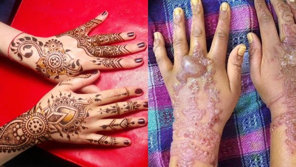 Татуировки набитые иглой