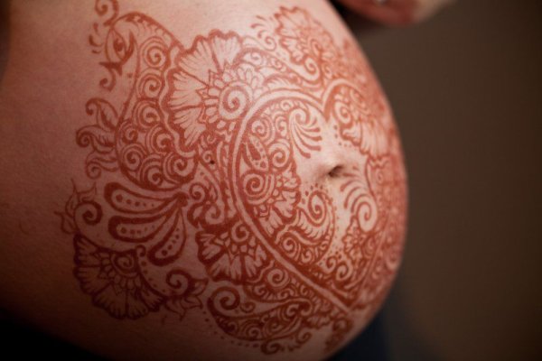 Аллергическая реакция на татуировку