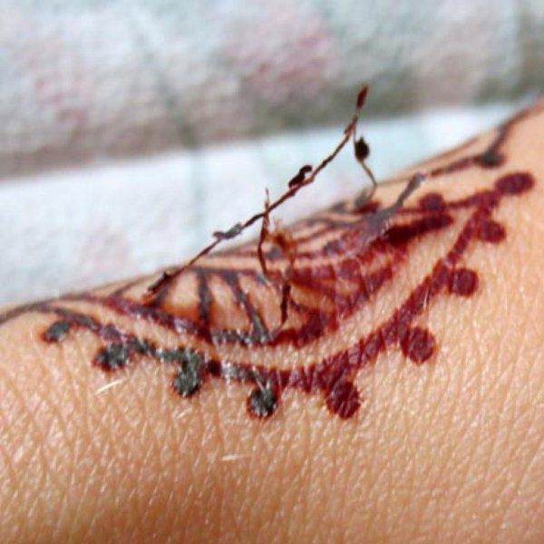 Перекрытие шрамов от ожогов