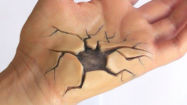 Порезы от когтей