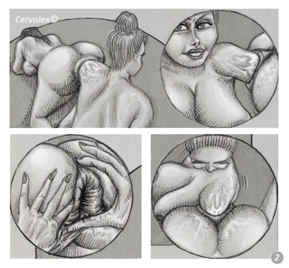 Рисунки вагинальный фистинг