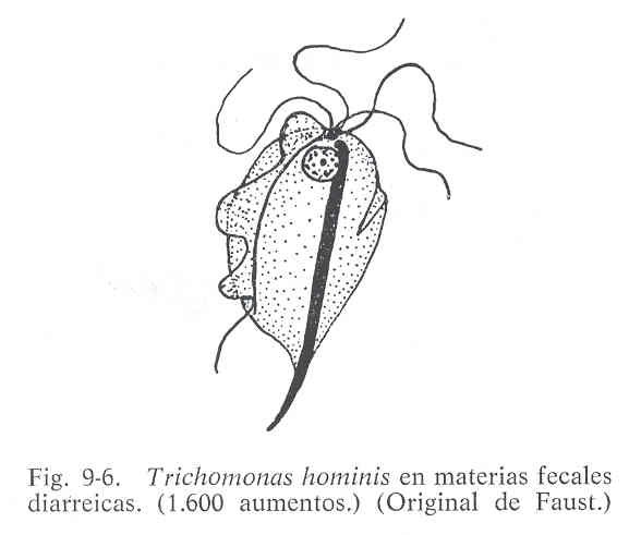 Урогенитальная трихомонада строение