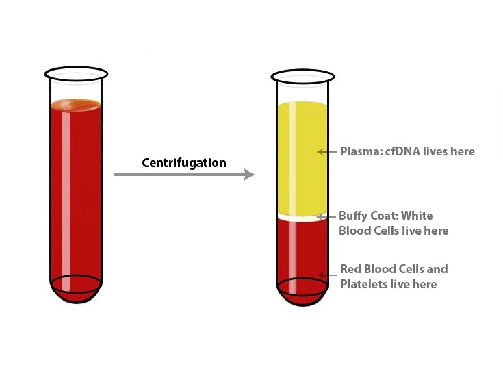Сыворотка крови биологических. Плазма крови после центрифугирования. Пробирка с кровью после центрифугирования. Сыворотка крови. Плазма крови в пробирке.