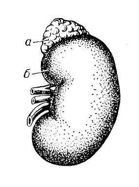 Почки надпочечники анатомия человека