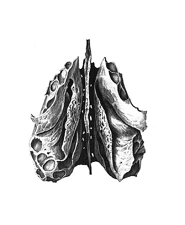 Решетчатая кость Синельников
