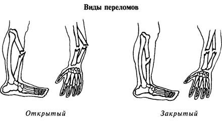 Травмы картина для детей