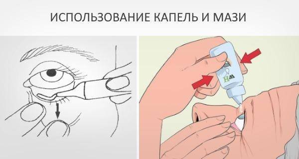 Конъюнктивальный путь введения