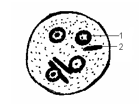 Циста дизентерийной амебы