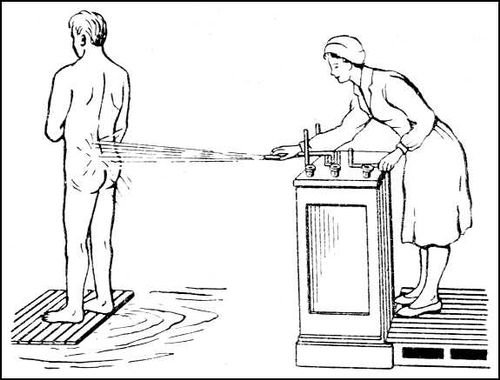 Душ Шарко в древности