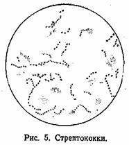Streptococcus pyogenes рисунок микробиология