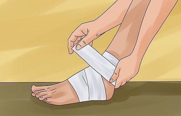 Подтаранный вывих стопы