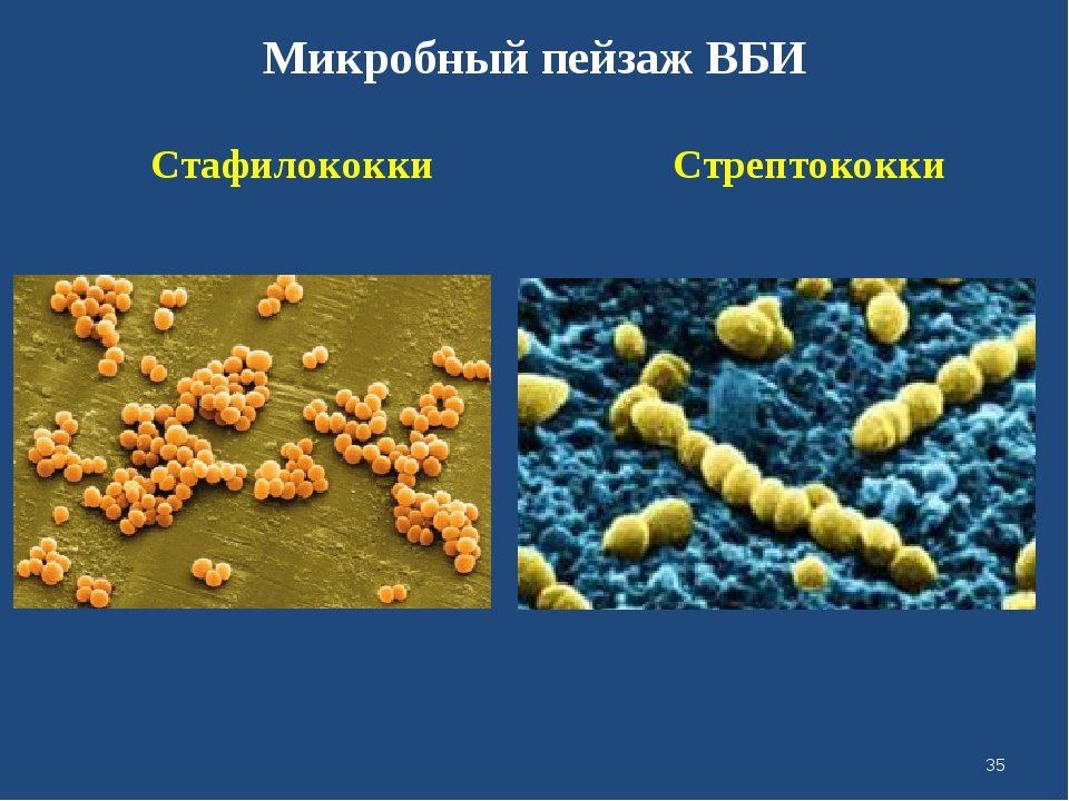 Staphylococcus aureus 4. Стафилококк строение. Бактерия стафилококк строение. Staphylococcus aureus строение. Золотистый стафилококк строение клетки.