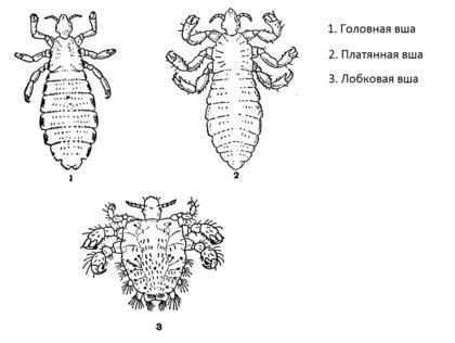 Головная вошь строение