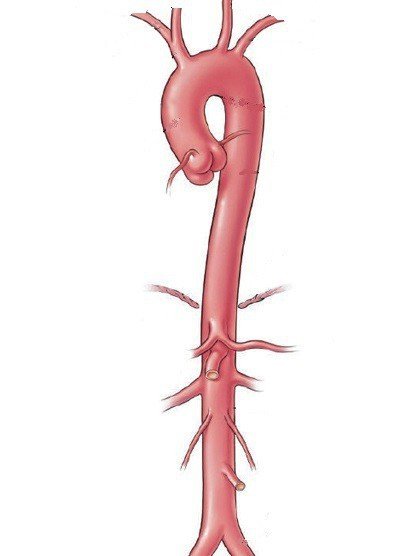 Сосуды дуги аорты анатомия