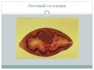 Яйца легочного сосальщика
