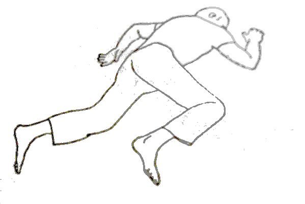 Позы трупа судебная медицина