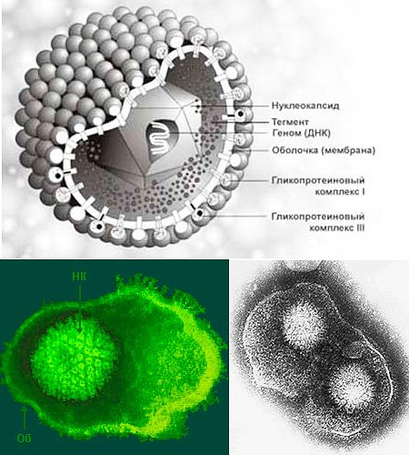 Герпесвирус строение вириона