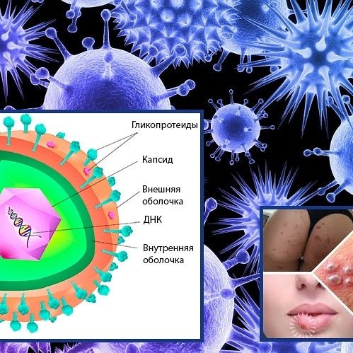 Вирус простого герпеса ВПГ 2