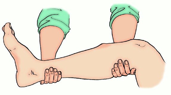 Вывих сустава первая помощь