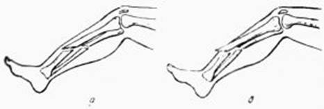 Закрытые и открытые травматические повреждения