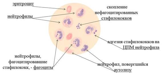 Фагоцитоз стафилококка(мазок крови)