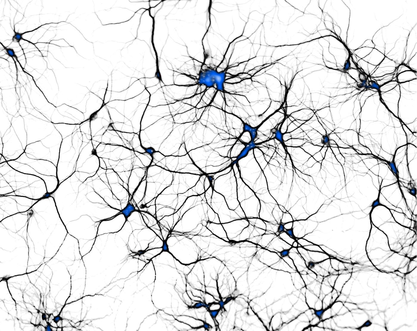 Как создать нейронные связи. Нейроны и нейронные связи. Нейрон фото. Нейронные связи головного мозга. Нейронные связи рисунок.