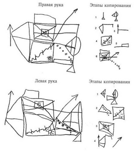 Фигуры Тейлора и Рея Остеррица для 6 лет