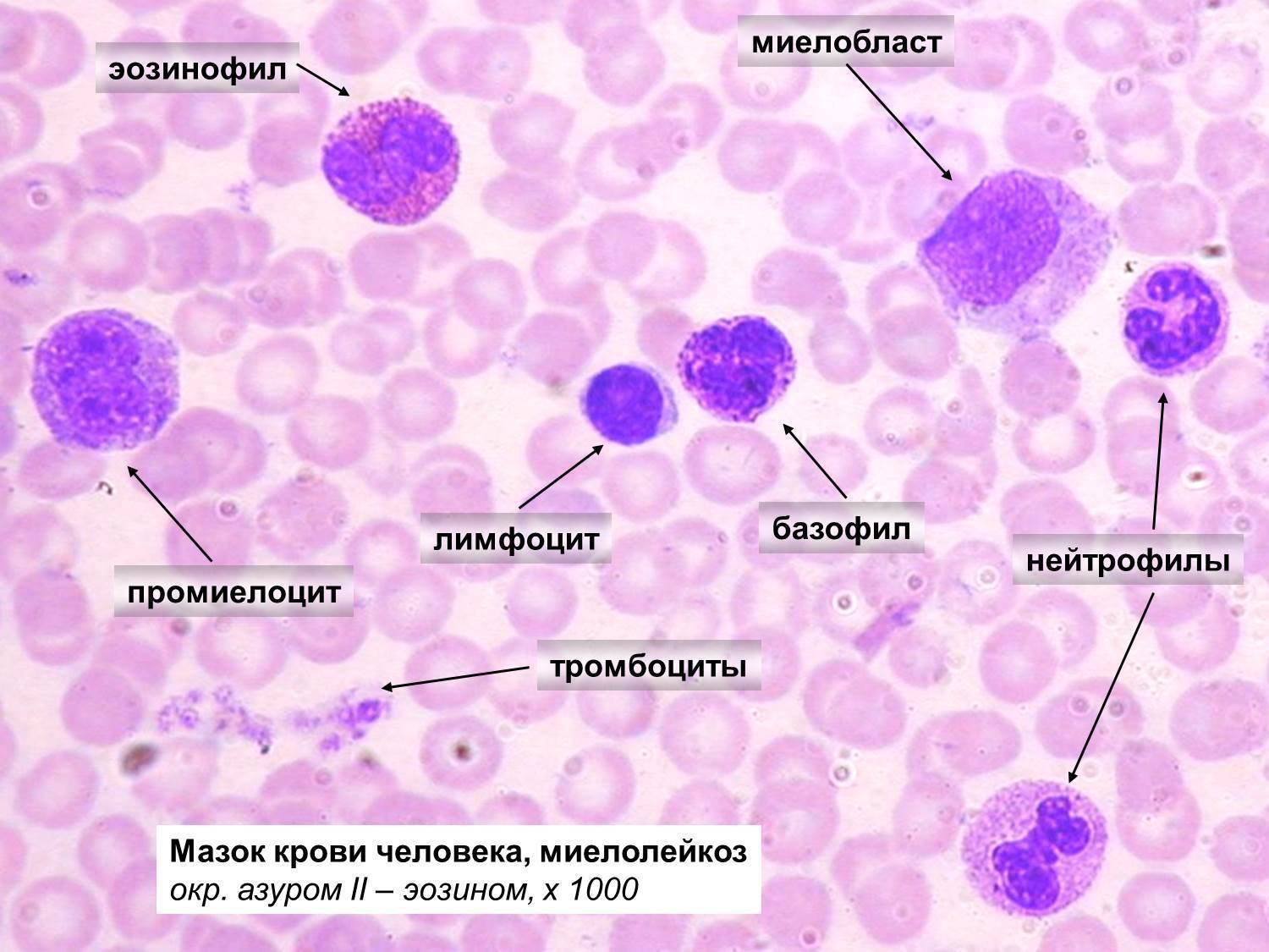 Лейкоциты нейтрофилы эозинофилы. Мазок крови лейкоциты гистология. Клетки крови мазок гистология. Мазок крови гистология препарат. Препарат крови человека лейкоциты.