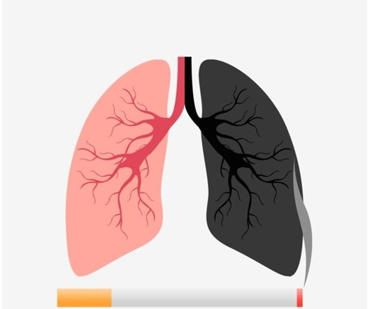 Легкие курильщика рисунок