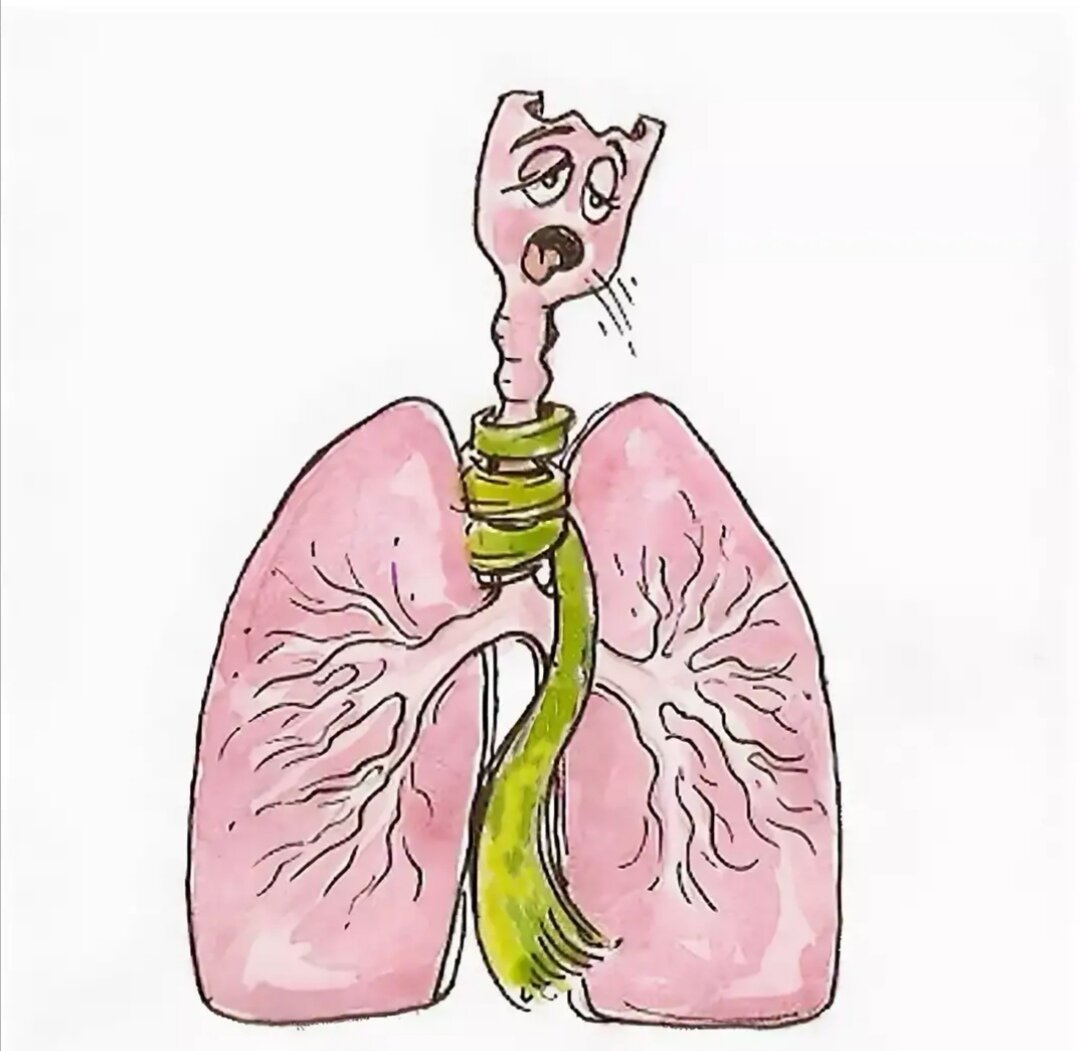 Обструкция дыхательных путей