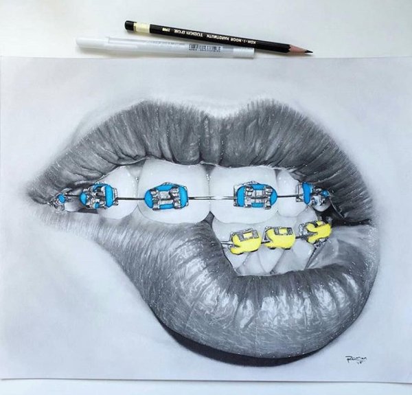 Зарисовка зуба