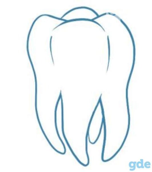 Зуб с имплантом вектор