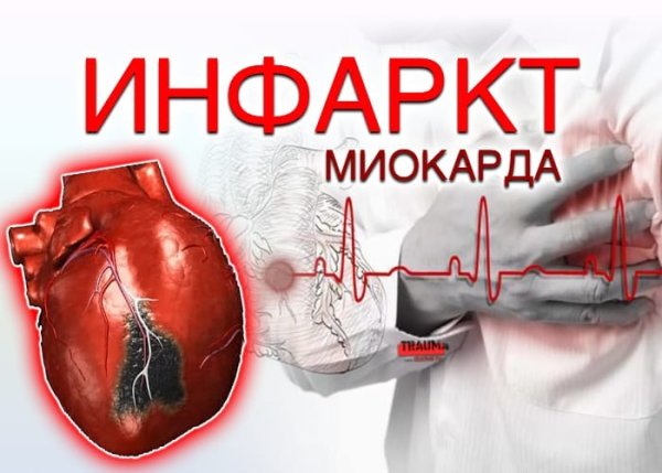Острый инфаркт миокарда сердце