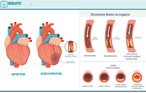 Инфаркт миокарда иконка