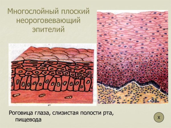 Многослойный ороговевающий эпителий