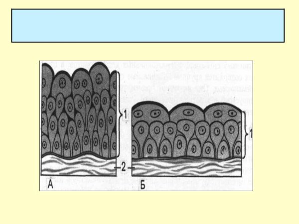 Чешуйчатый неороговевающий эпителий
